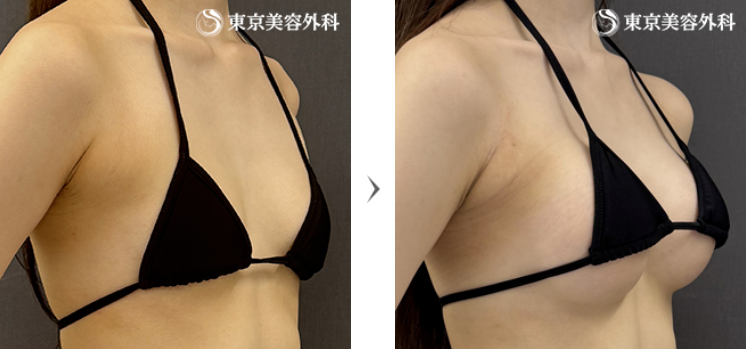 【2026年7月最新】豊胸手術どこがいい?人気クリニック徹底比較|Beauty Finder